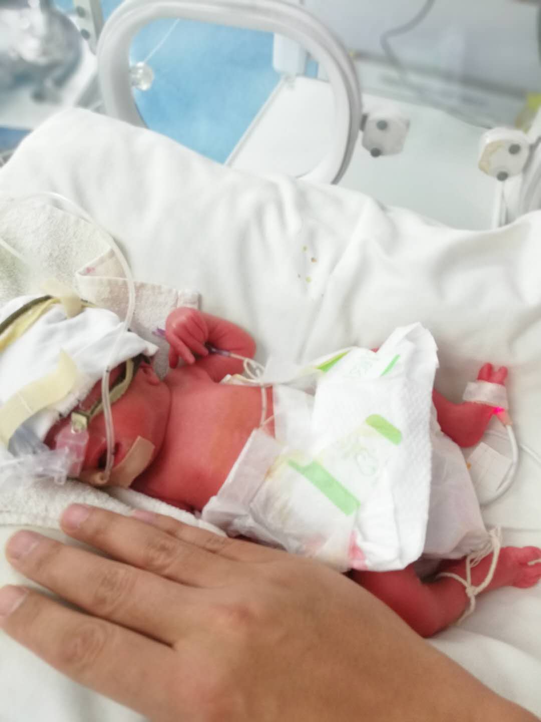 近日,一则来自温岭一院新生儿科的医生在轻松筹里为一对29周早产儿双